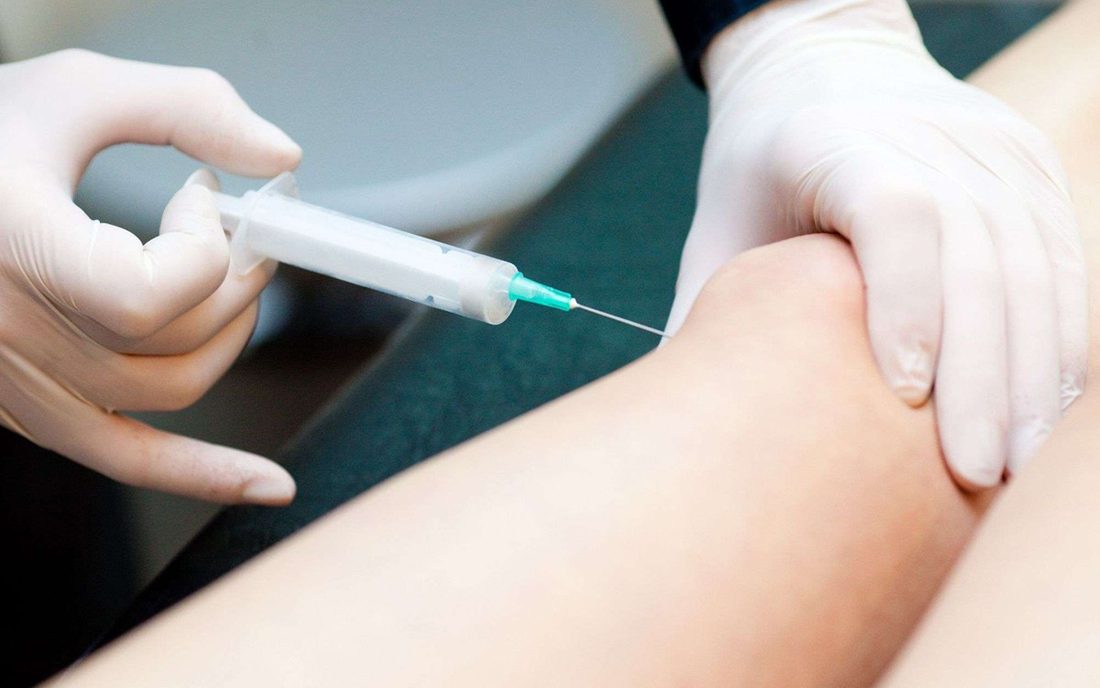 Valoración de rodilla y cadera antes de programar un reemplazo articular