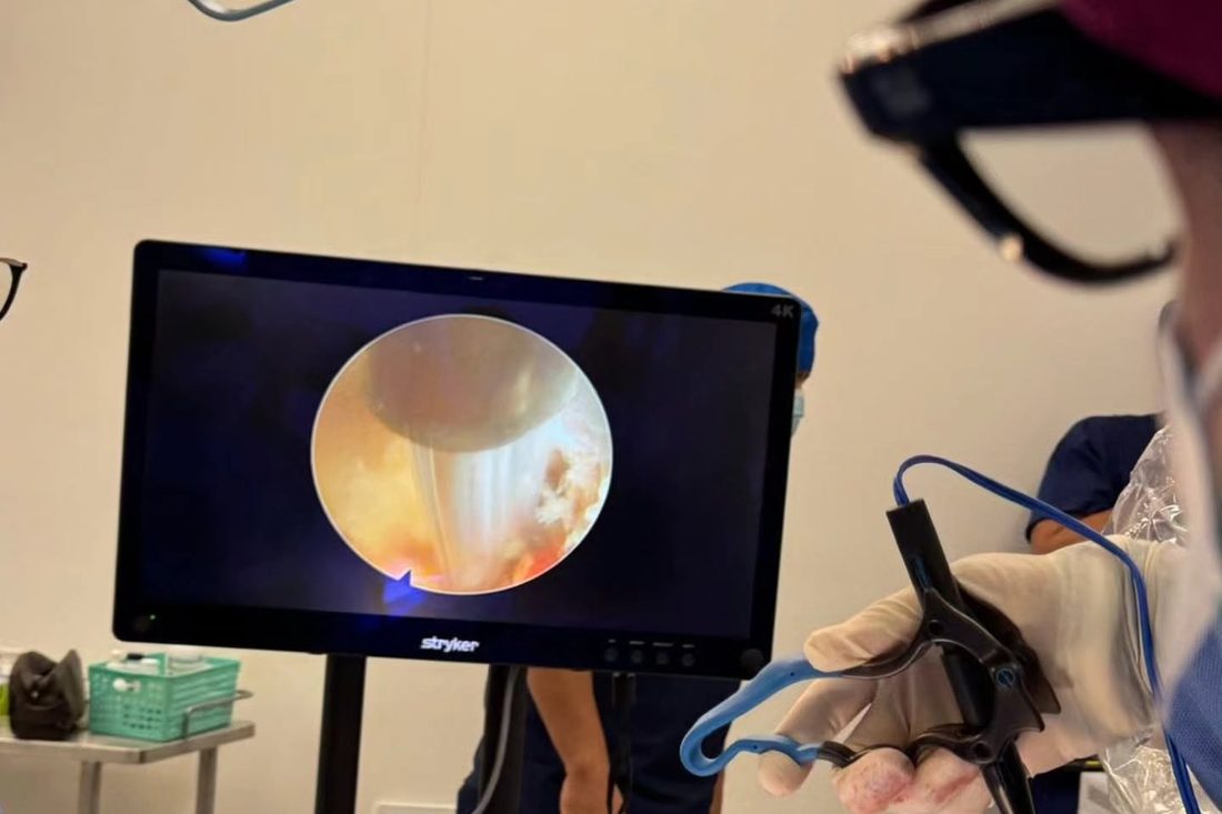 Monitor de quirófano con la imagen de una endoscopia de columna durante el procedimiento