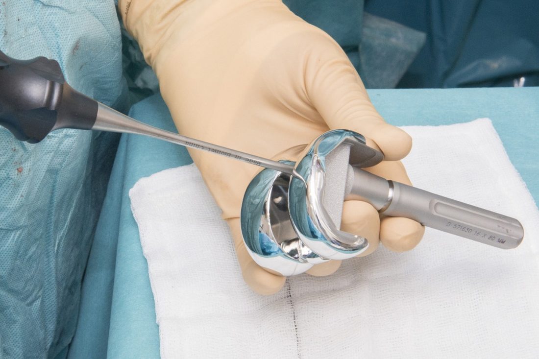 Componentes de una prótesis total de rodilla sobre la mesa de instrumental