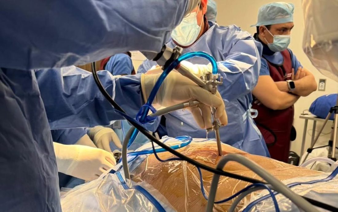Quirófano durante una cirugía de columna, con la torre de endoscopia en primer plano